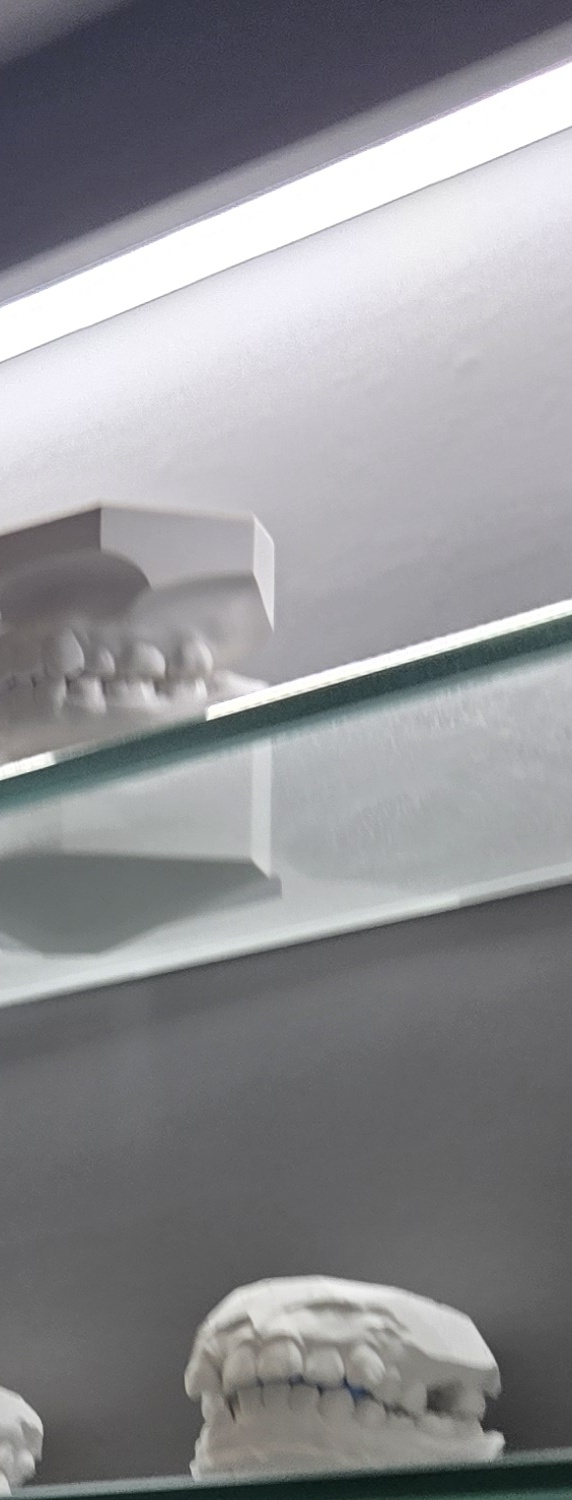 치과 치아미백 효과 어떤식으로 나타날까 관련 이미지 34