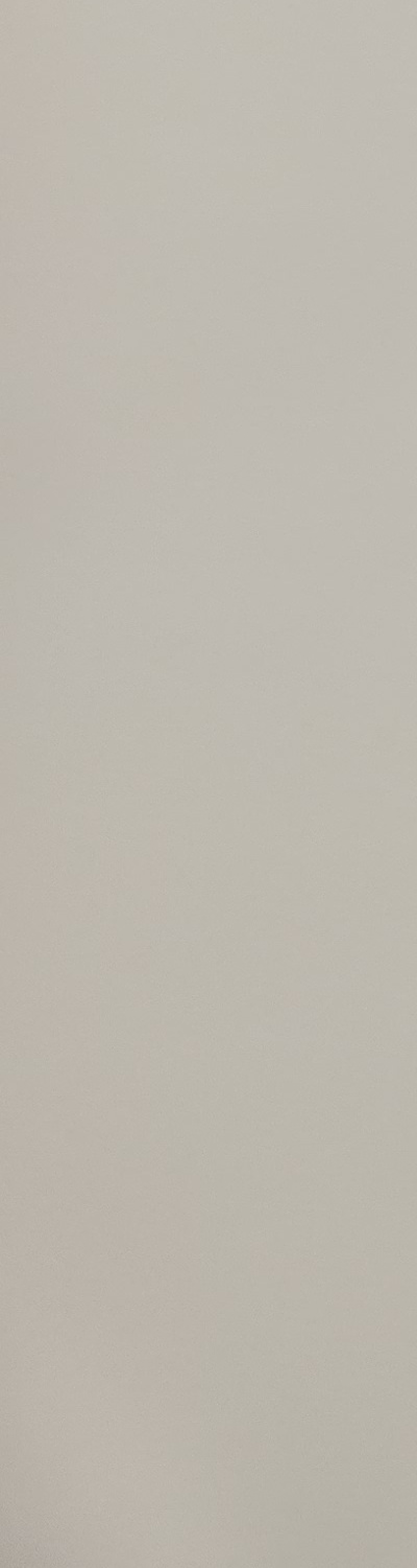 앞니 크라운 교체 깔끔하게 정리하려면 관련 이미지 19