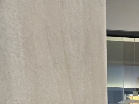 65세이상 임플란트 개수 구체적으로 체크하려면 관련 이미지 10