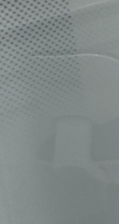 충치 검은점 나타났다면 이렇게 대처해요 관련 이미지 31