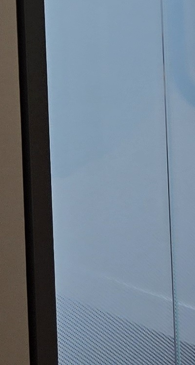 아말감 교체 레진 인레이 어떻게 대처하면 될까 관련 이미지 45