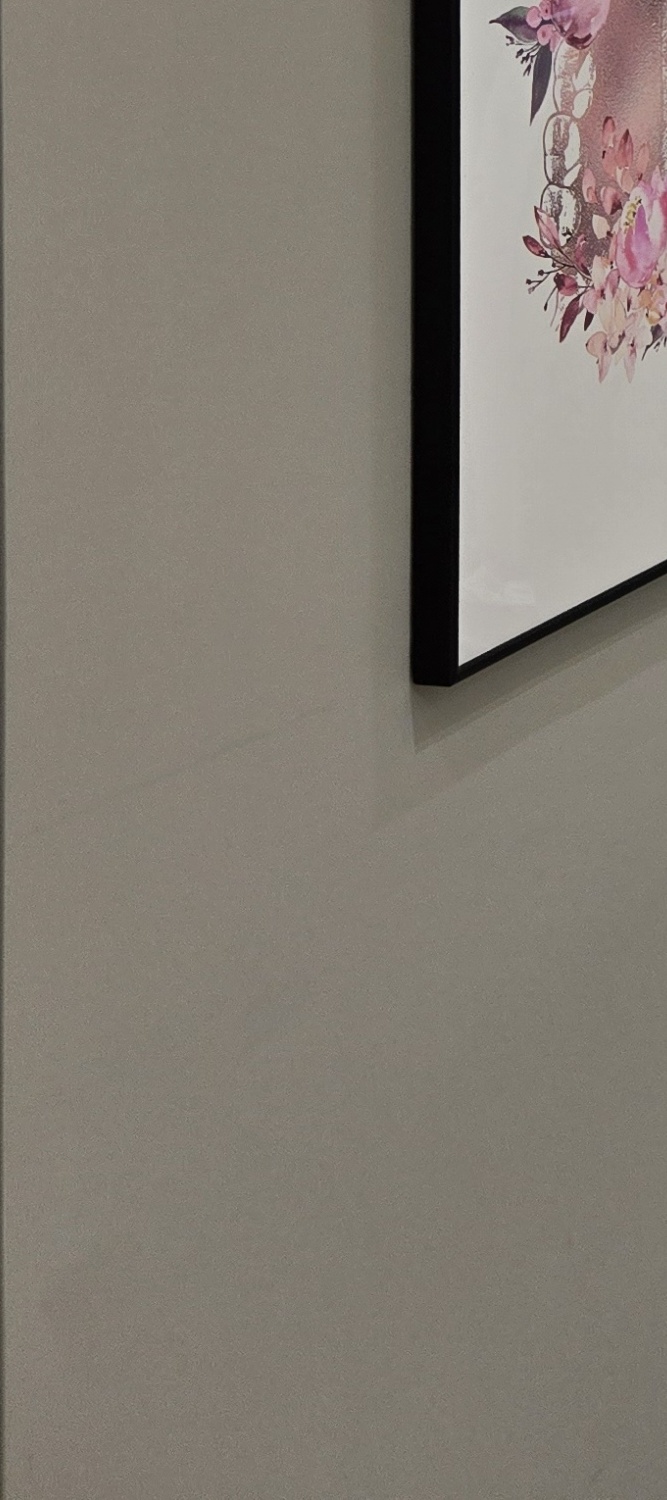 앞니 틀어짐 교정 방법 이럴때는 좀더 간단해요 관련 이미지 28