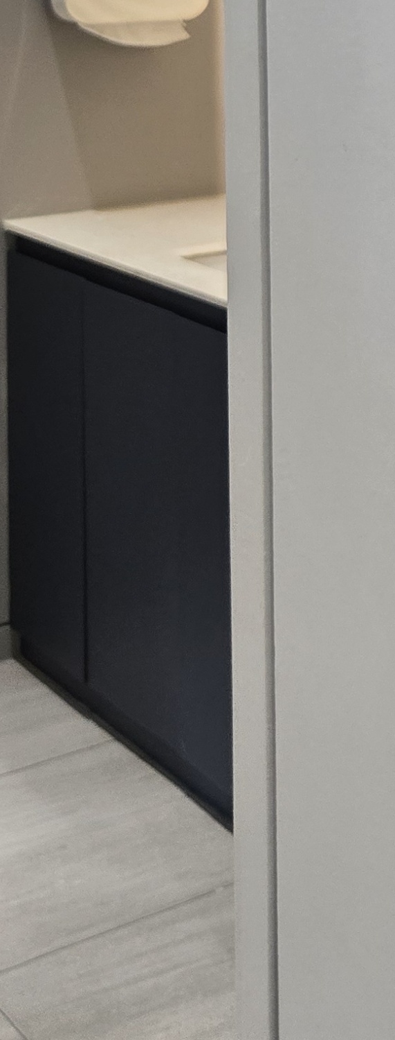 앞니 크라운 교체 깔끔하게 정리하려면 관련 이미지 37