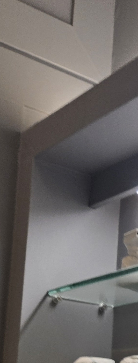 치과 치아미백 효과 어떤식으로 나타날까 관련 이미지 31