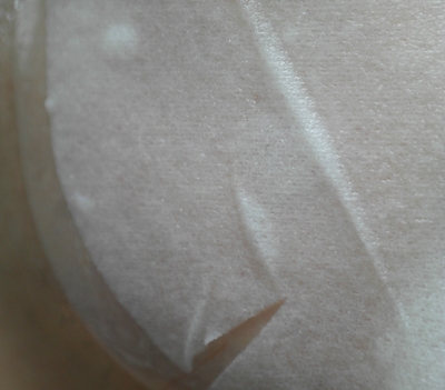 연예인피부관리 병원가면 vip관리에 쓰이는 마스크팩 관련 이미지 8