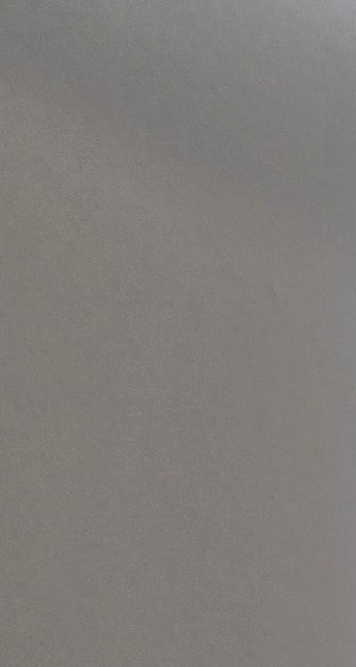 앞니 틀어짐 교정 조화롭게 마무리하려면 관련 이미지 13