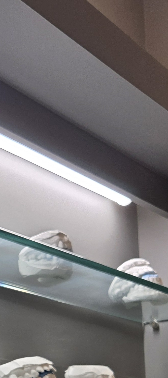 어금니 임플란트 통증 어렵게 느껴진다면 관련 이미지 32
