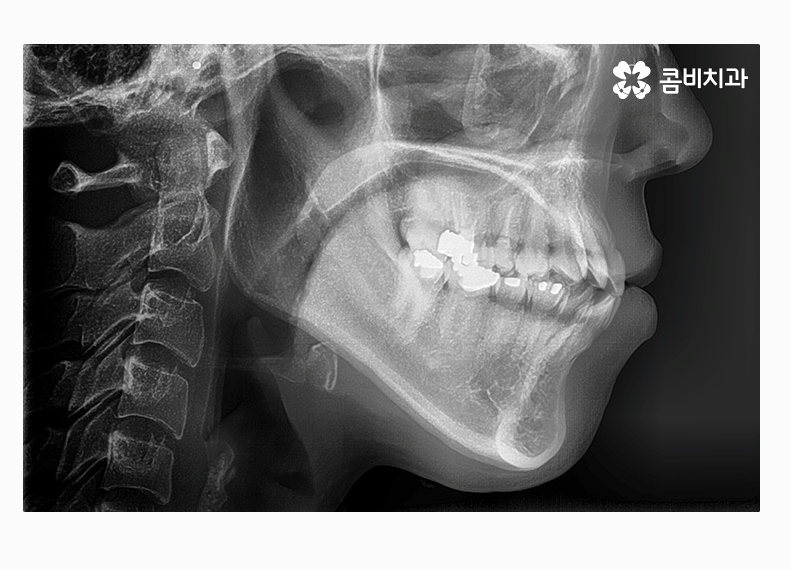 콤비교정 합리적으로 판단하려면 관련 이미지 4