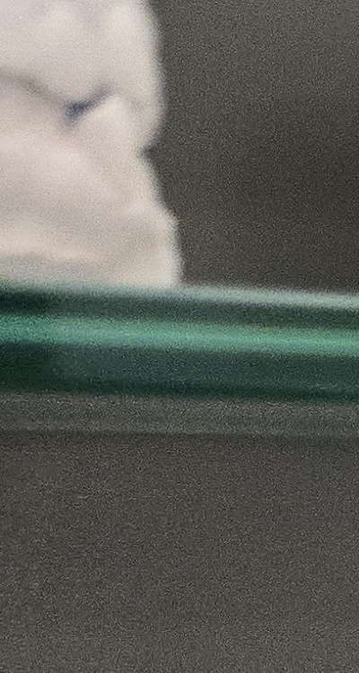 사랑니 주변 잇몸 통증 지금부터가 중요하니까 관련 이미지 22