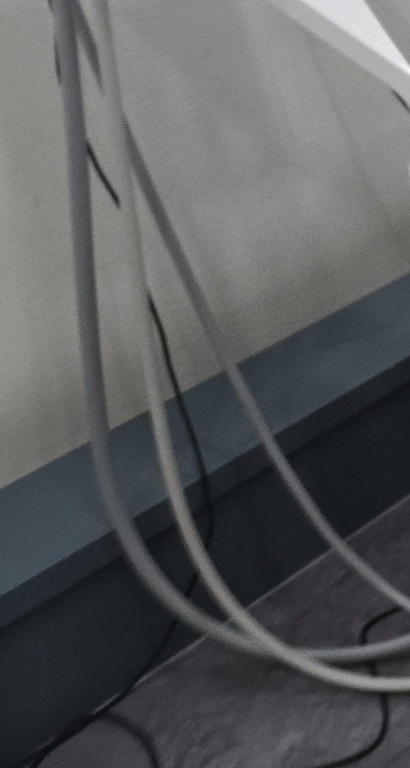 어금니 임플란트 뼈이식 이럴때 해당됩니다 관련 이미지 16