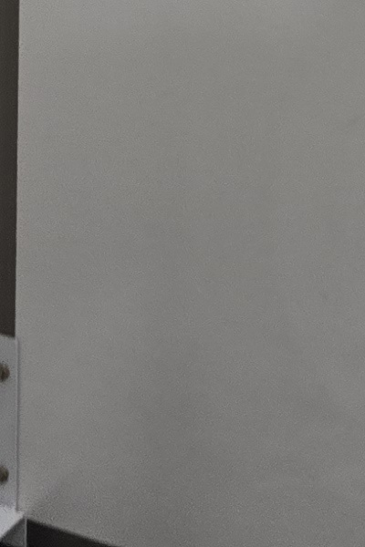 부정교합 교정 안하면 생기는 문제는 뭔가요 관련 이미지 54