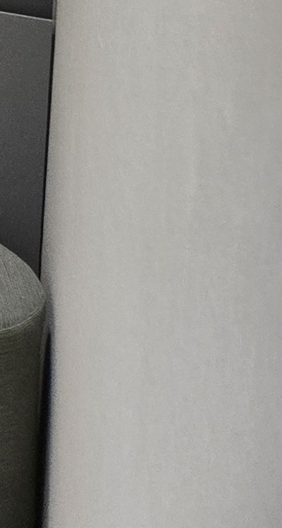 아래 사랑니 발치 통증 미리 알고 대처하려면 관련 이미지 48