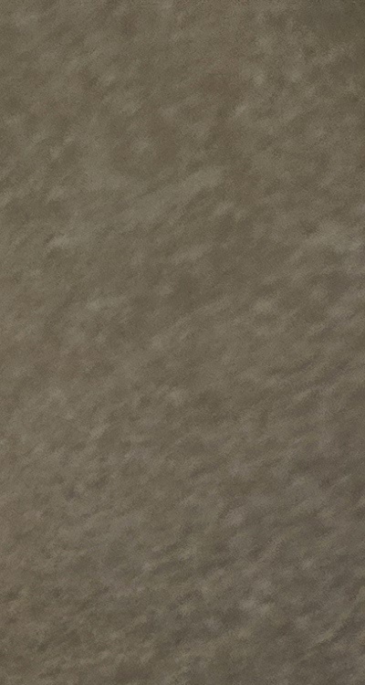 반대교합 치아교정 해결 가능할까 관련 이미지 17