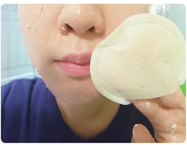 얼굴피지제거 놓치지 말아요 관련 이미지 7