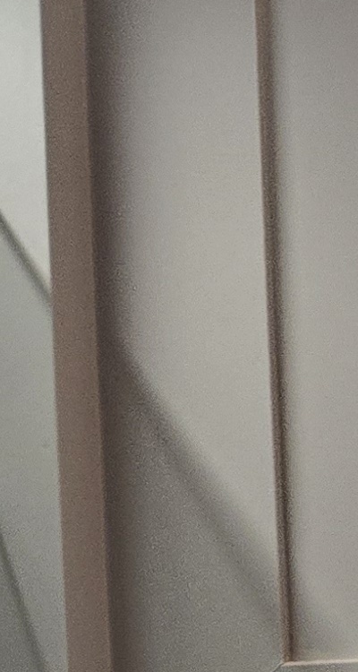 완전매복사랑니 발치 대학병원 꼭 가야하나요 관련 이미지 26