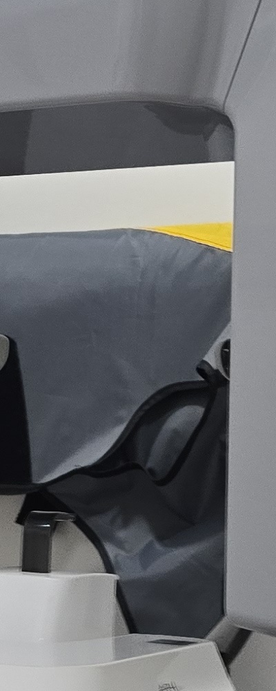 인레이 치료 후 신경치료 이유가 궁금하다면 관련 이미지 28