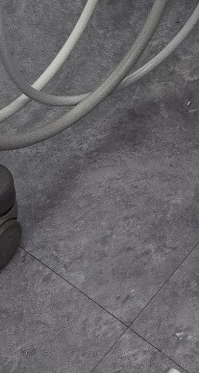 어금니 임플란트 안하면 후회하게 되는걸까 관련 이미지 46