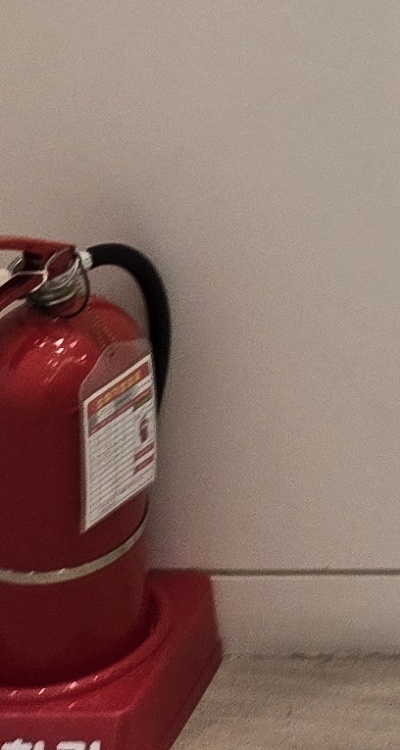 앞니 올세라믹 이건 알고 시작하세요 관련 이미지 42