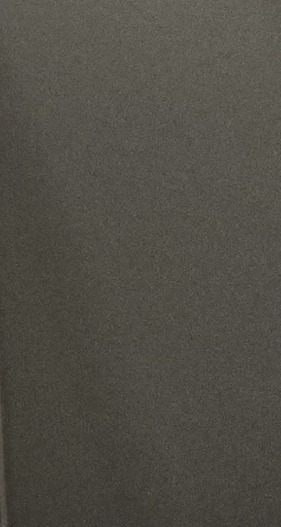 완전매복사랑니 발치 대학병원 꼭 가야하나요 관련 이미지 47