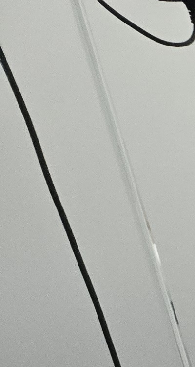 어금니 임플란트 안하면 후회하게 되는걸까 관련 이미지 13