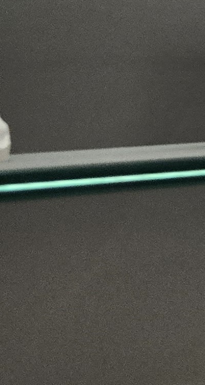 완전매복사랑니 발치 대학병원 꼭 가야하나요 관련 이미지 30