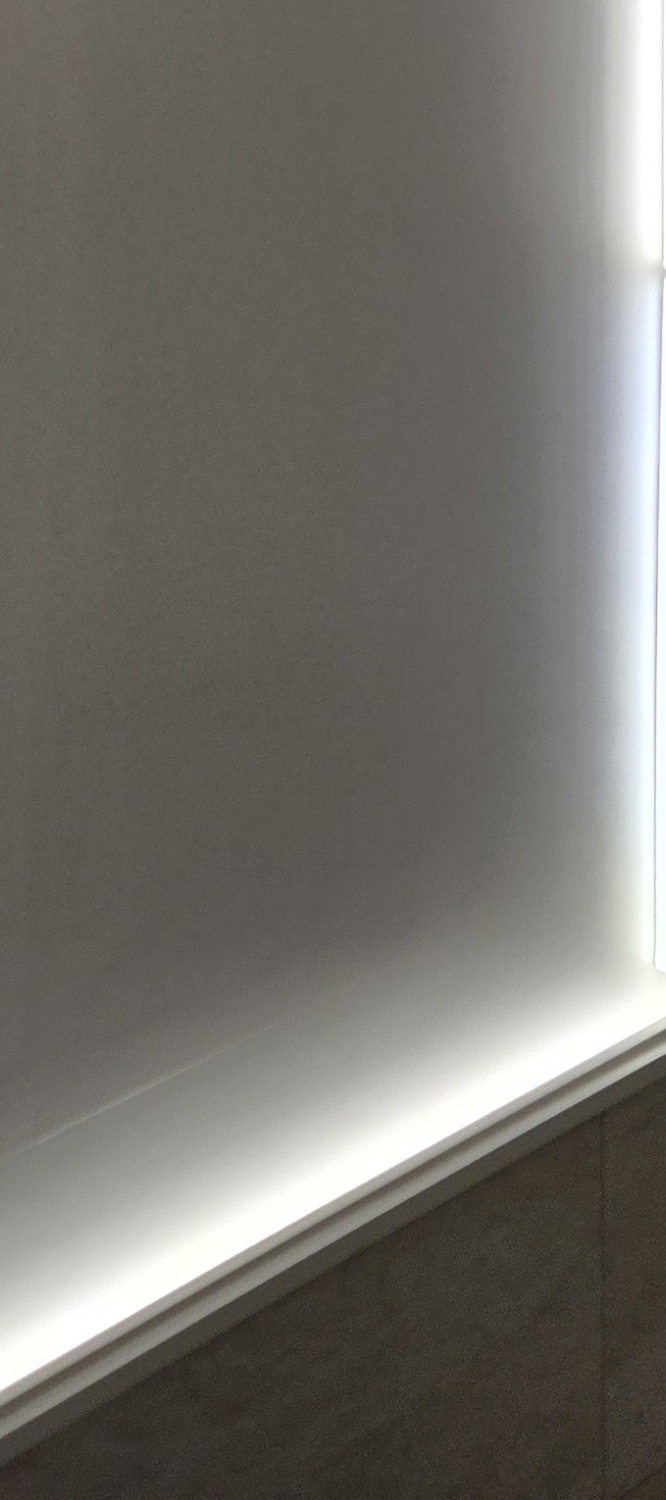 어금니 충치 단계 미리 알아차리려면 관련 이미지 22