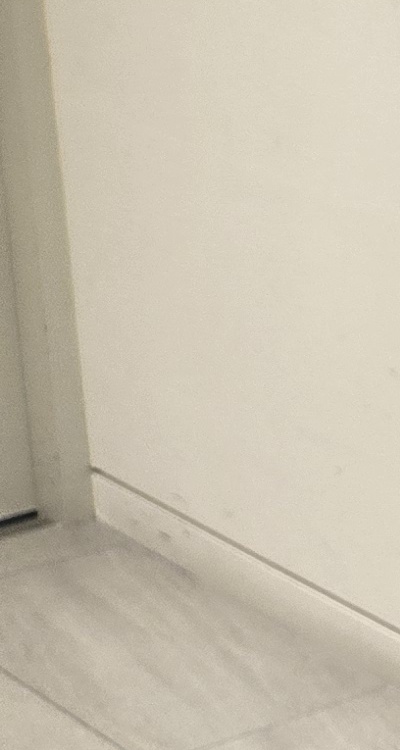 송곳니 크라운 티가 안나게 해결 가능한건가요 관련 이미지 30