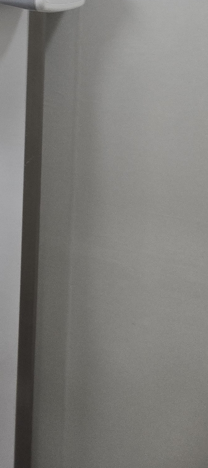 앞니 틀어짐 교정 이렇게 파악하세요 관련 이미지 33