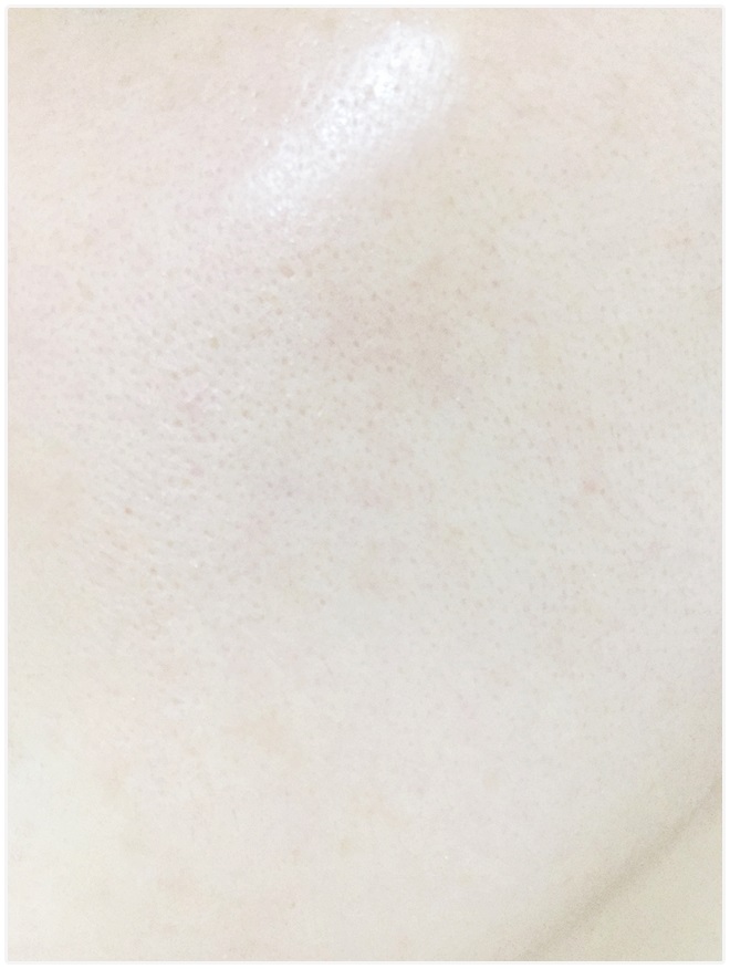 모공화장품 보람이 있네! 관련 이미지 6