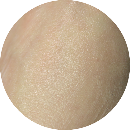 아토피보습제 보송함이 다르네요 관련 이미지 11