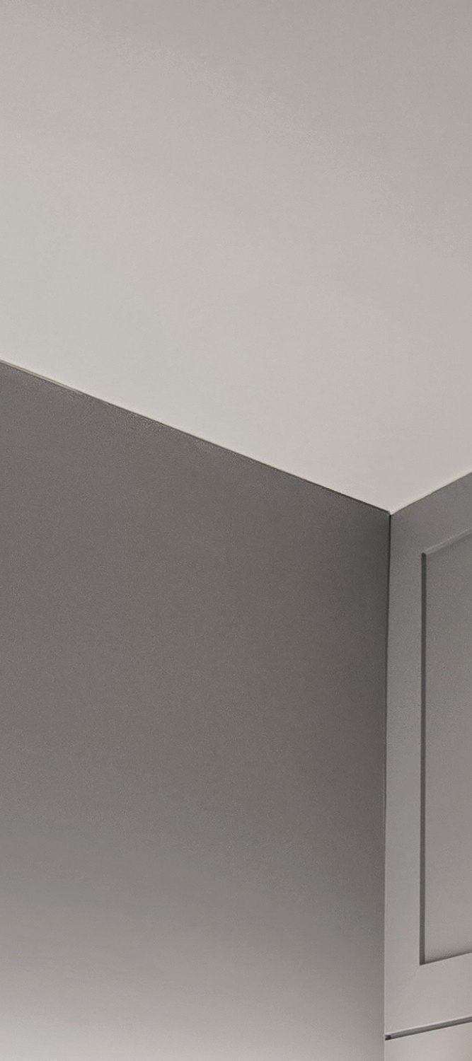 어금니 임플란트 뼈이식 이럴때 해당됩니다 관련 이미지 23