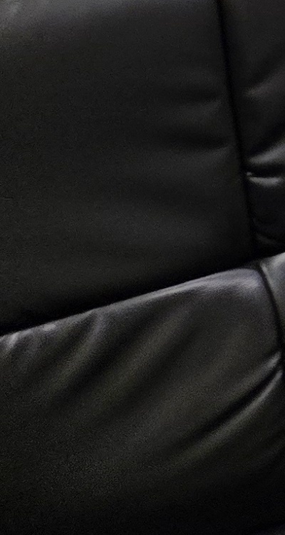 임플란트 뼈이식 안하면 어떤 문제가 있는거죠 관련 이미지 43