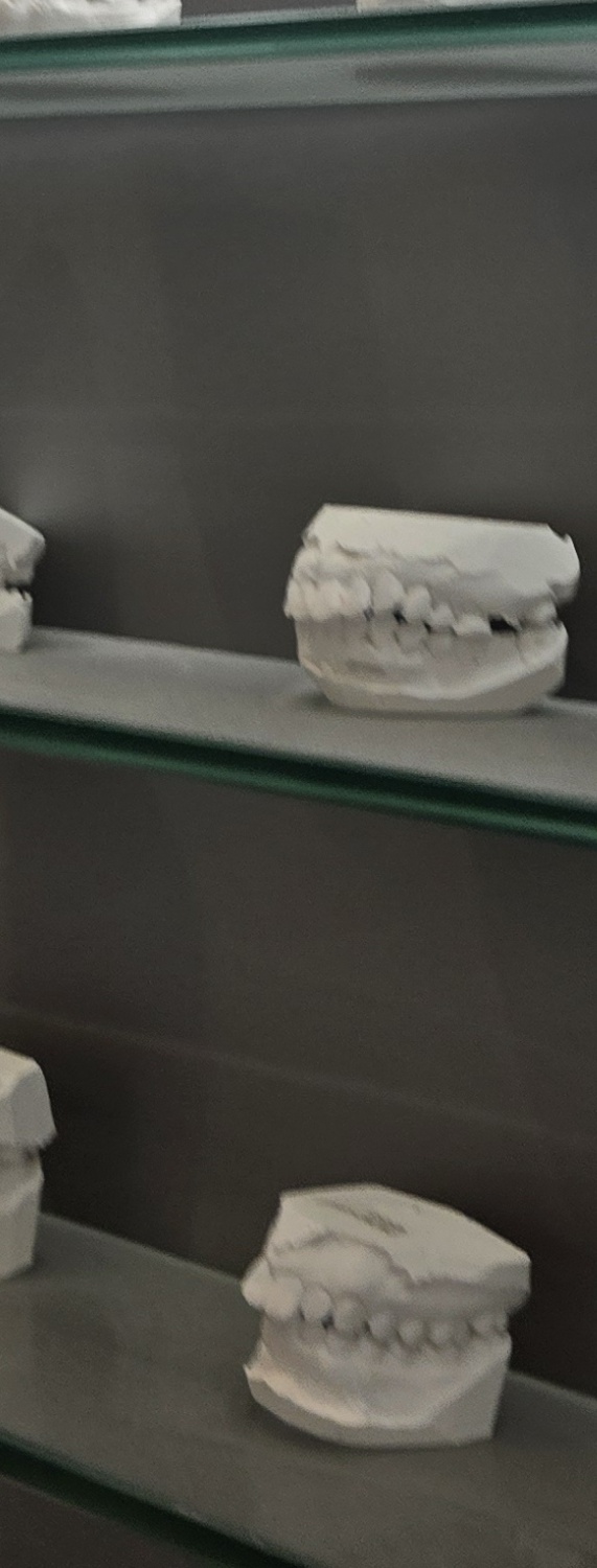 치과 치아미백 효과 어떤식으로 나타날까 관련 이미지 40