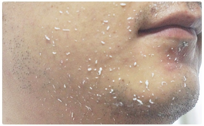 남자피부관리 신경써야지 관련 이미지 5