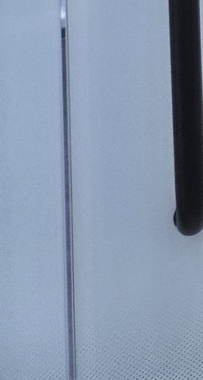 사랑니 발치 후 충치 치료 둘다 준비하려면 관련 이미지 41