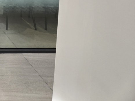 65세이상 임플란트 개수 구체적으로 체크하려면 관련 이미지 18