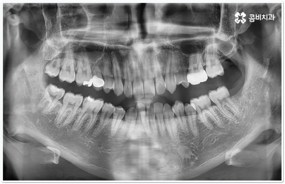 클리피씨교정 합리적인 초이스! 관련 이미지 2
