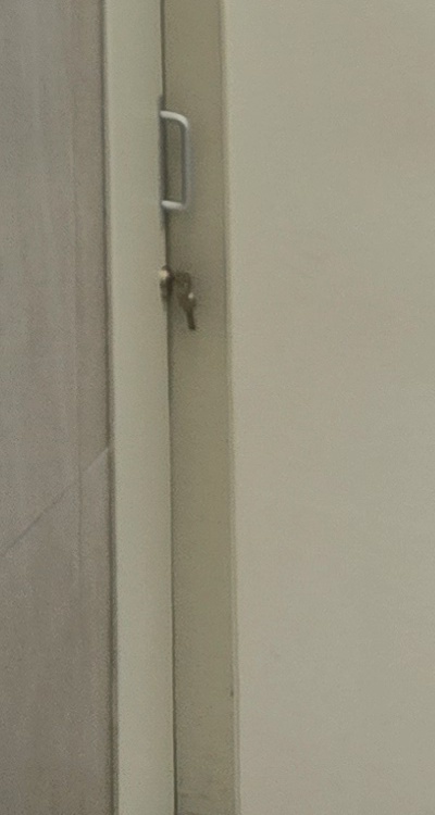 앞니 신경치료 크라운 까지 해야할 상황이라면 관련 이미지 49