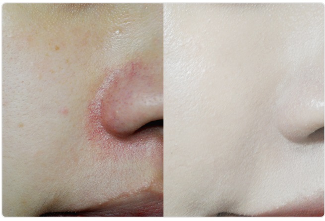 커버력좋은쿠션 어쩜이리좋아 관련 이미지 7