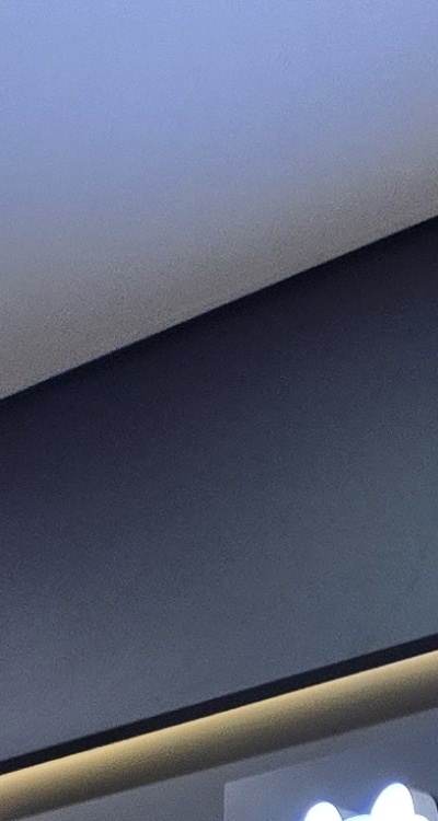 치아 발치 후 임플란트 언제부터 준비할까 관련 이미지 14