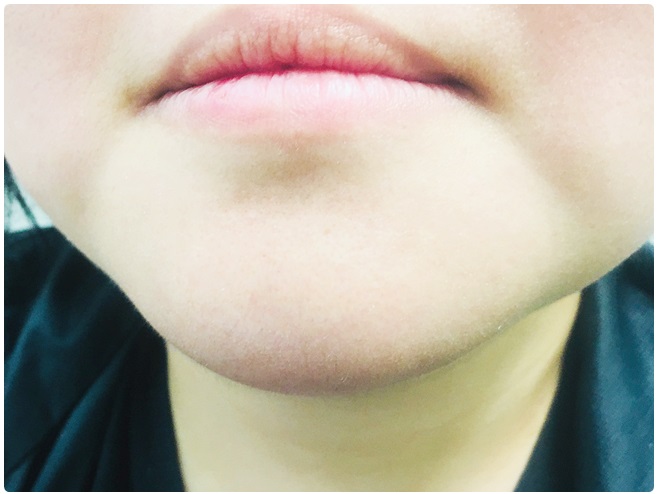 피부탄력 제대로 관리하자 관련 이미지 10