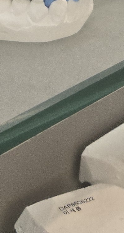 앞니 틀어짐 부분교정 얼마나 걸릴까 관련 이미지 46