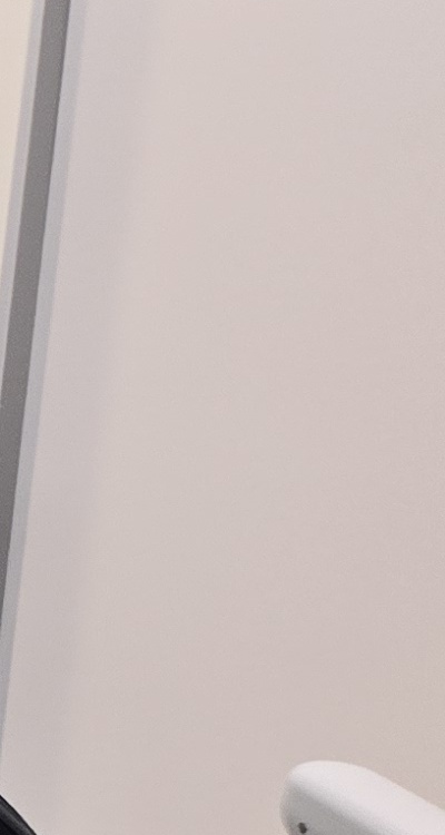 충치 검은점 나타났다면 이렇게 대처해요 관련 이미지 30