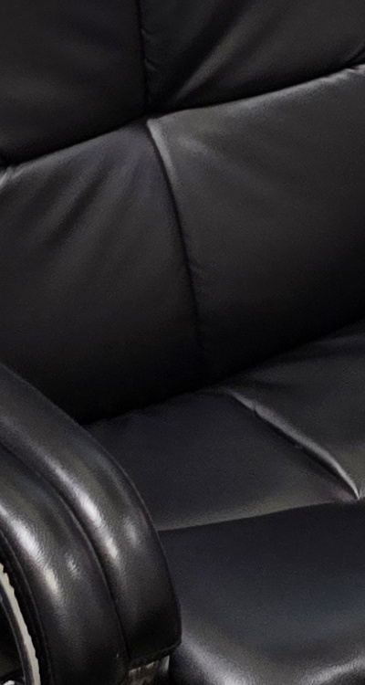 돌출입 팔자주름 교정 얼마나 바뀔까요 관련 이미지 45