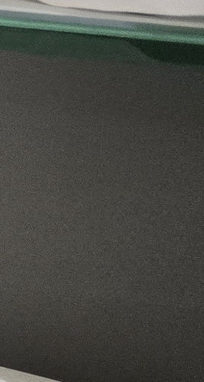 윗니 전체 임플란트 뭐부터 해야할까 관련 이미지 39