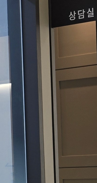 아말감 교체 레진 인레이 어떻게 대처하면 될까 관련 이미지 27