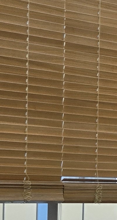 돌출입 팔자주름 교정 얼마나 바뀔까요 관련 이미지 23