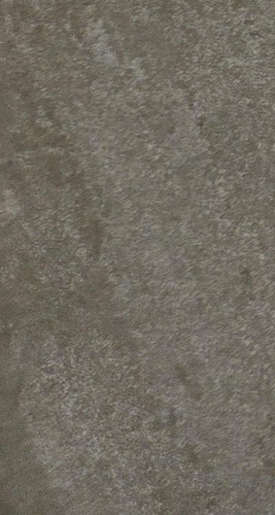 앞니 신경치료 크라운 까지 해야할 상황이라면 관련 이미지 41