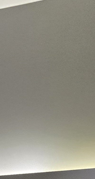 아래 사랑니 발치 통증 미리 알고 대처하려면 관련 이미지 15