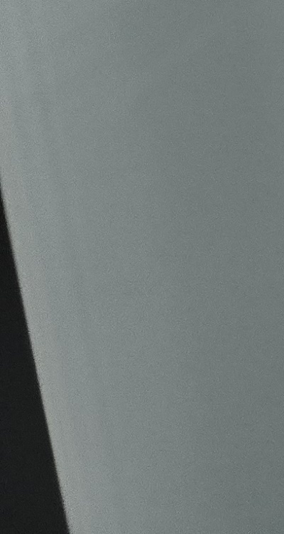 충치 검은점 나타났다면 이렇게 대처해요 관련 이미지 41